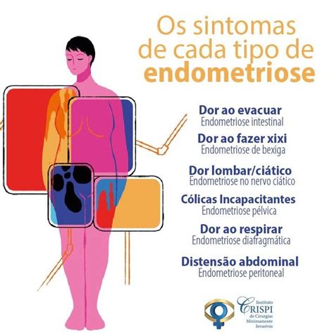 endometriose sintomas dor nas costas